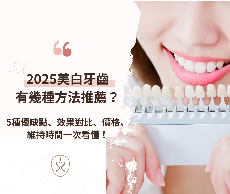 2025美白牙齒有幾種方法推薦？5種優缺點、效果對比、價格、維持時間一次看懂！(上篇)